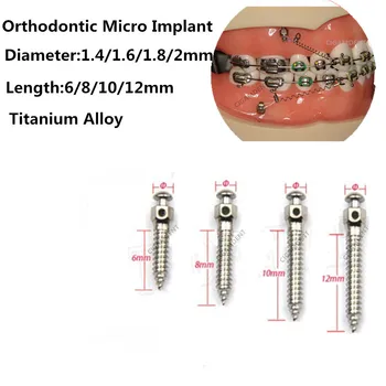 2Pcs Dentário Ortodôntico Mini Implante de Micro Parafusos de Liga de Titânio do Implante chave de Fenda Chave de Auto-Perfuração 1.4/1.6/1.8/2.0 mm