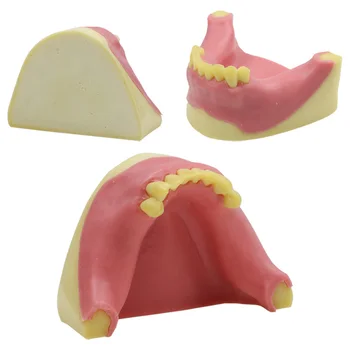 Implante dentário Prática do Modelo com a Goma com os Dentes Superiores Modelo Odontológica Materiais Dentários Instrumento